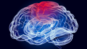 Brain scan or injured brain
